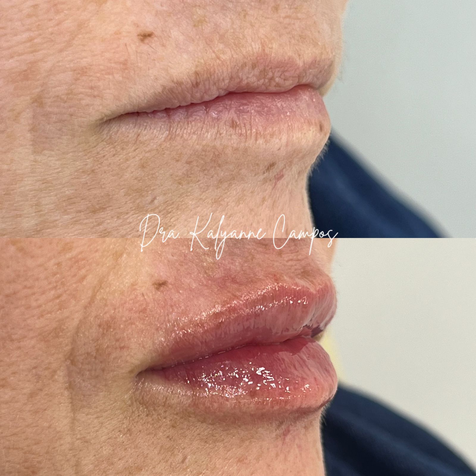 Resultado Estético Facial Avançado